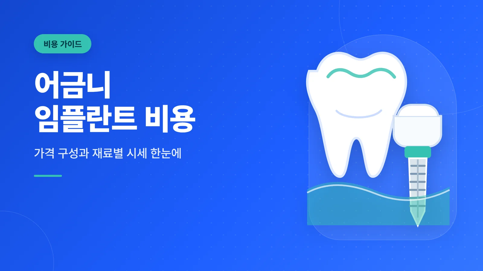 어금니 임플란트 비용