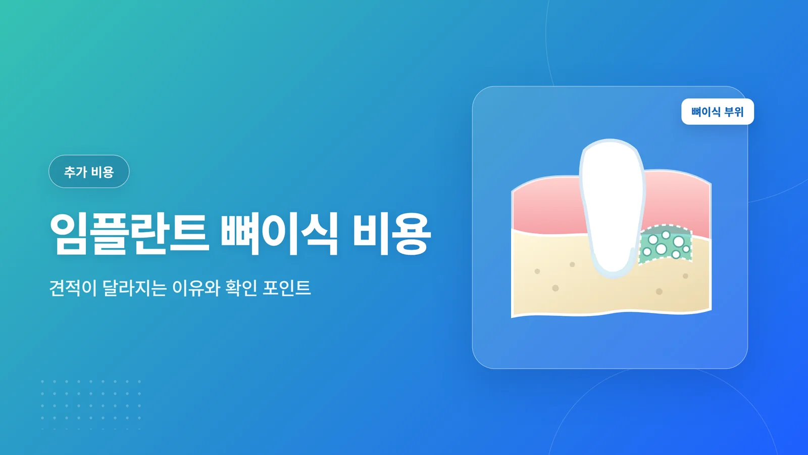 임플란트 뼈이식 비용