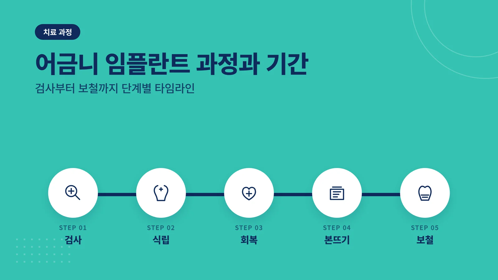 어금니 임플란트 과정과 기간
